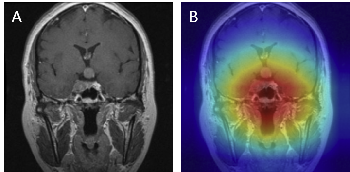Pituitary Correct